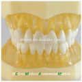 Modelo dental 13013 de la mandíbula suave transparente modelo anatómico médica de China